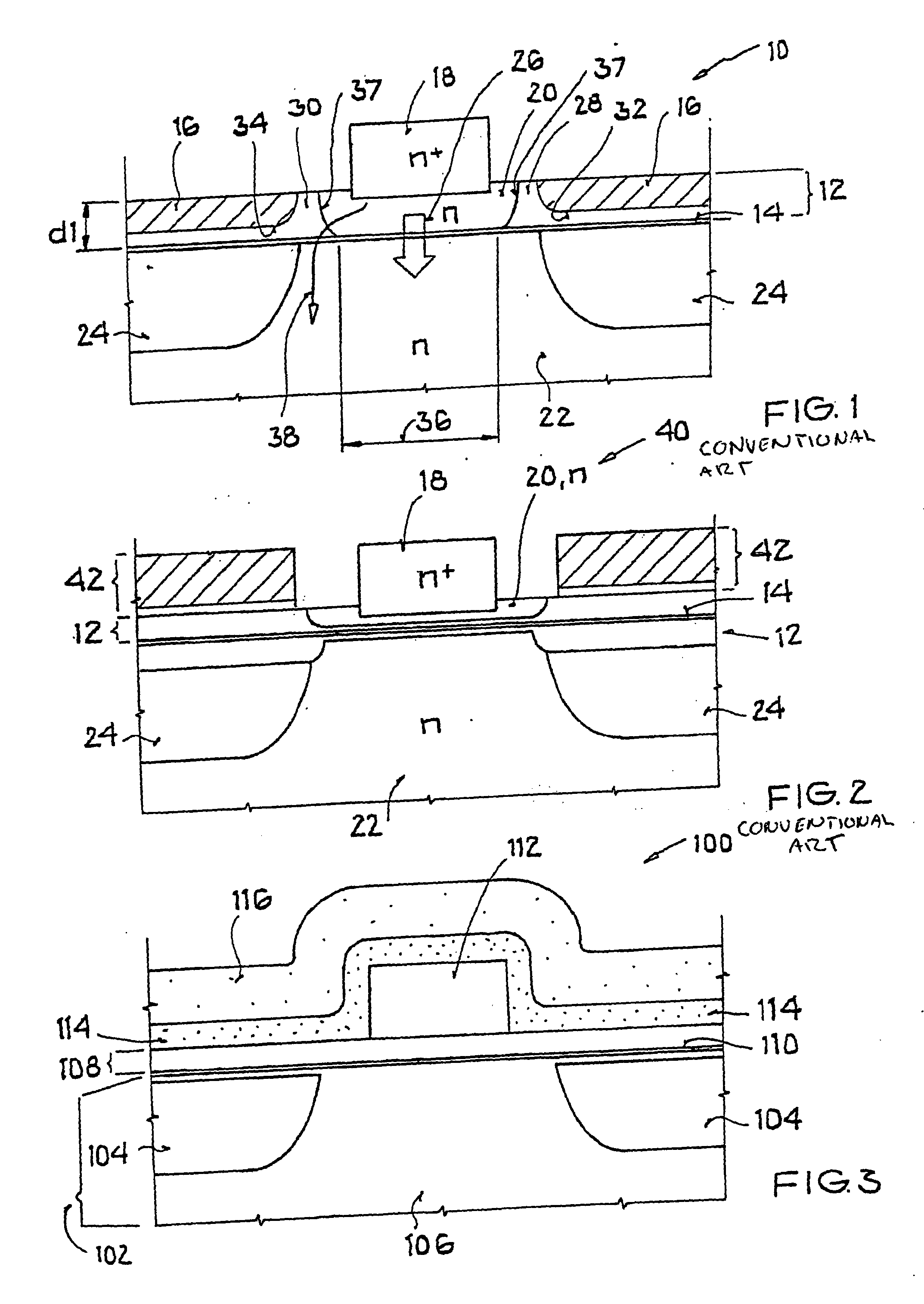 Process for producing a base connection of a bipolar transistor