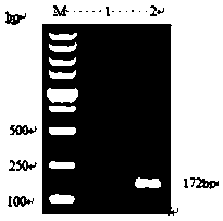 Bovine babesiosisbigemina nested PCR specific primer as well as detection kit and nested PCR detection method