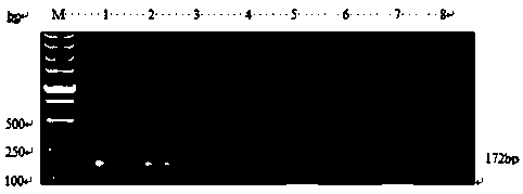 Bovine babesiosisbigemina nested PCR specific primer as well as detection kit and nested PCR detection method