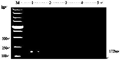 Bovine babesiosisbigemina nested PCR specific primer as well as detection kit and nested PCR detection method