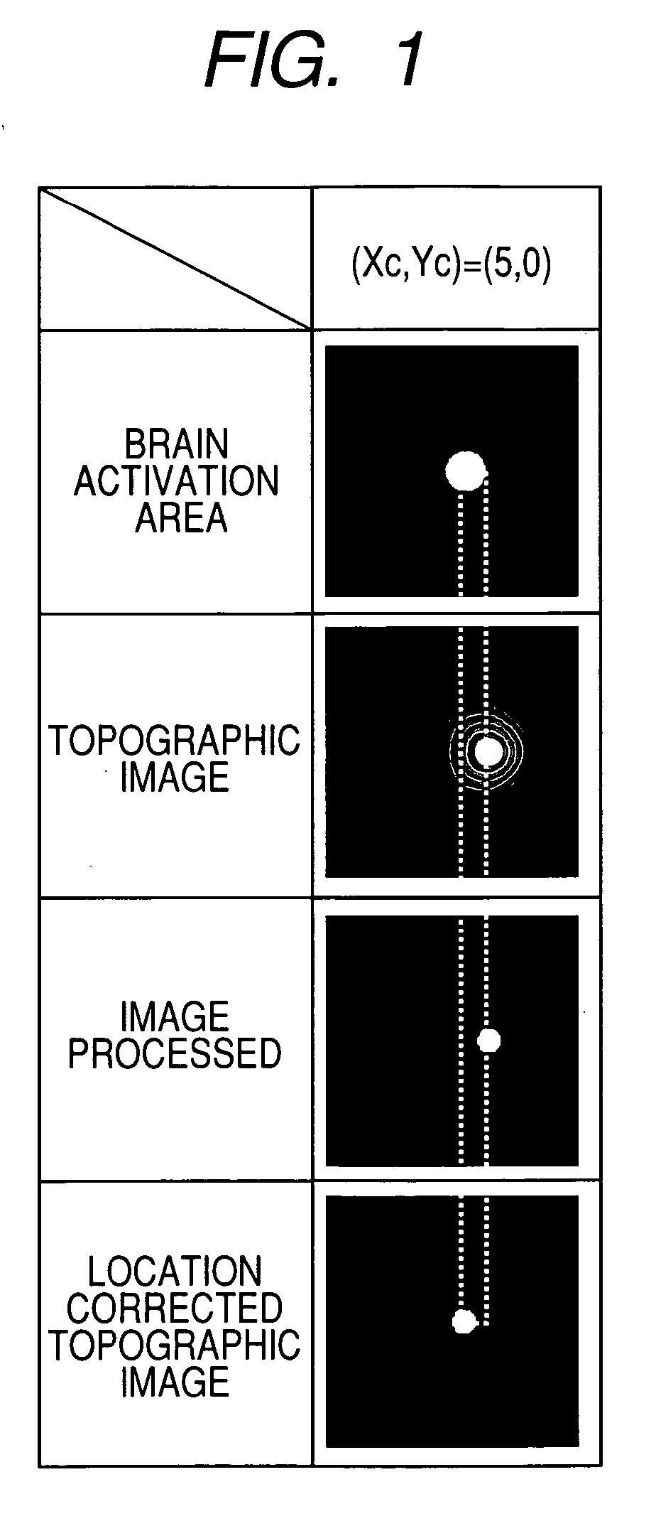 Living body light measurement system and signal processing method