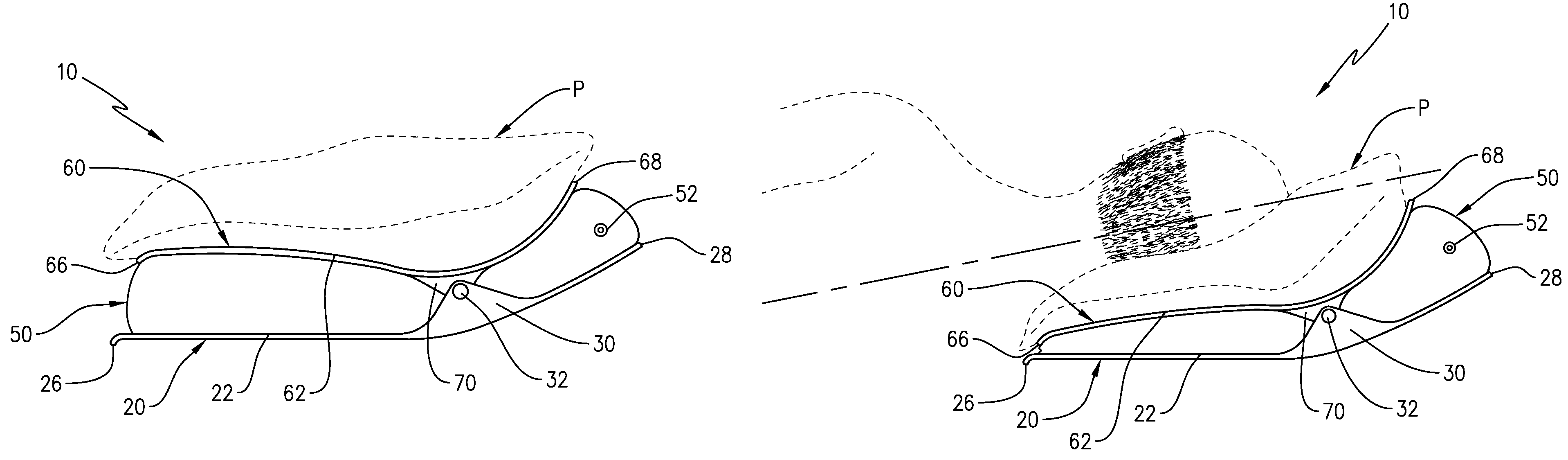 Method with apparatus to prevent baldness and stimulate hair growth