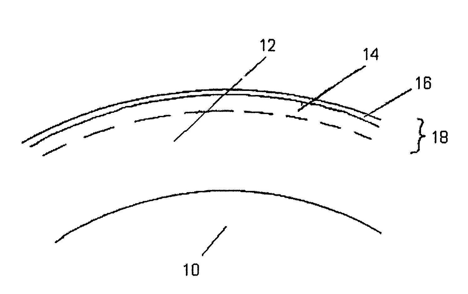 Process to mold a plastic optical article with integrated hard coating