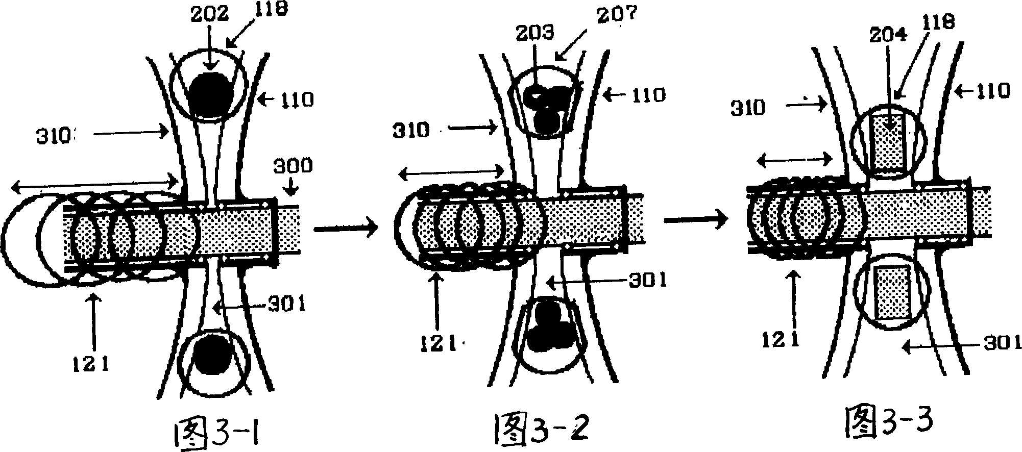 Gearing chain ring and its application in speed variator