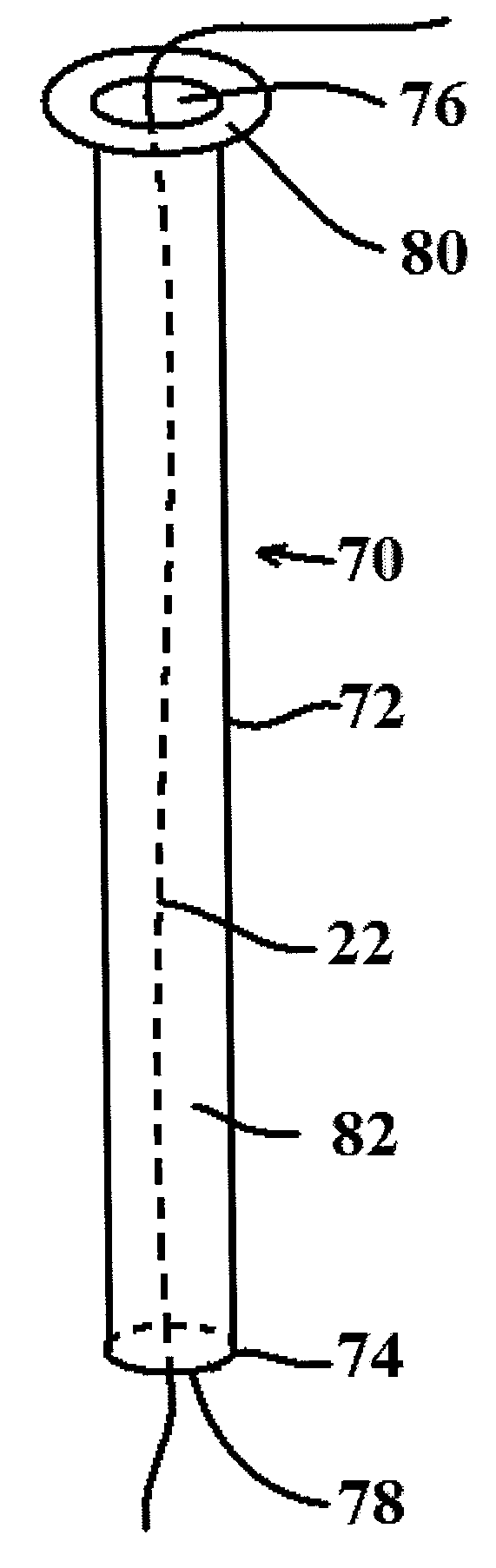 Suture anchoring system and method