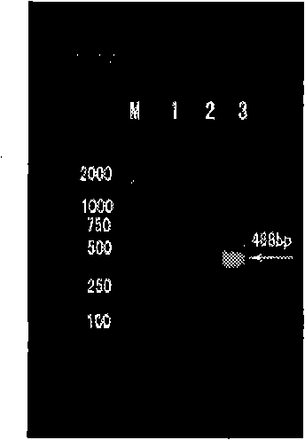 Reagent for detecting antiepileptic drug allergic reaction associated antigen genetype and clinical application method