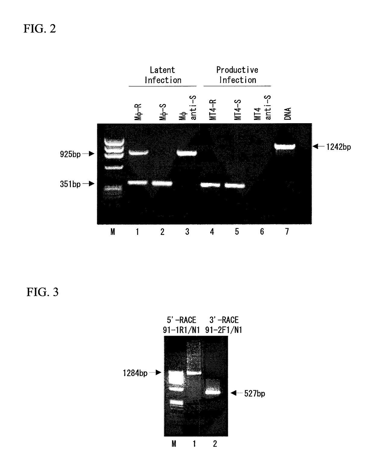 Method for treating or preventing mood disorders