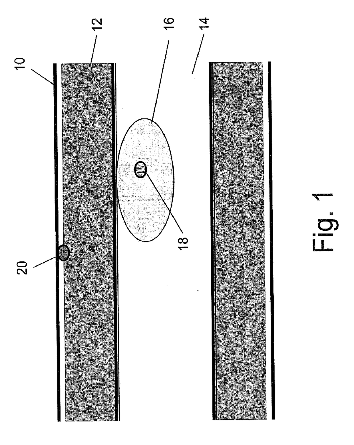 System for implanting, activating, and operating an implantable battery