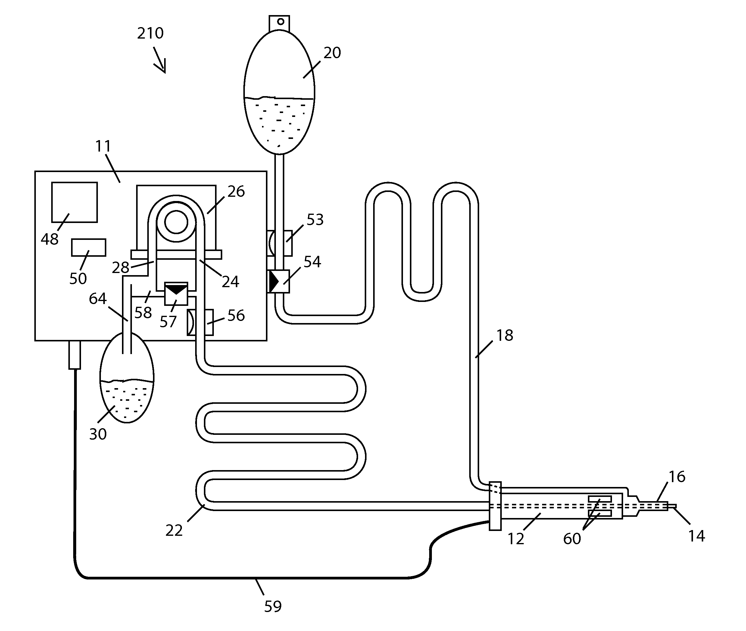 Post-occlusion chamber collapse suppressing system for a surgical apparatus and method of use