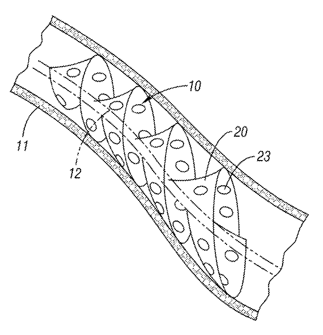 Helical embolic protection device