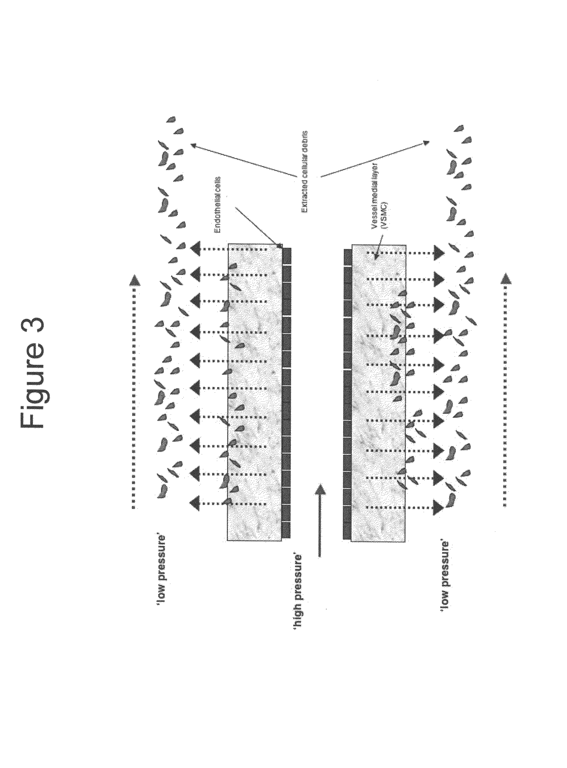 Decellularized grafts from umbilical cord vessels and process for preparing and using same
