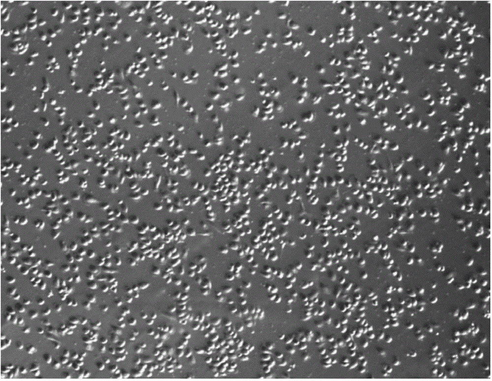 Tumor specific target and application thereof in preparing preparation for cellular immunotherapy