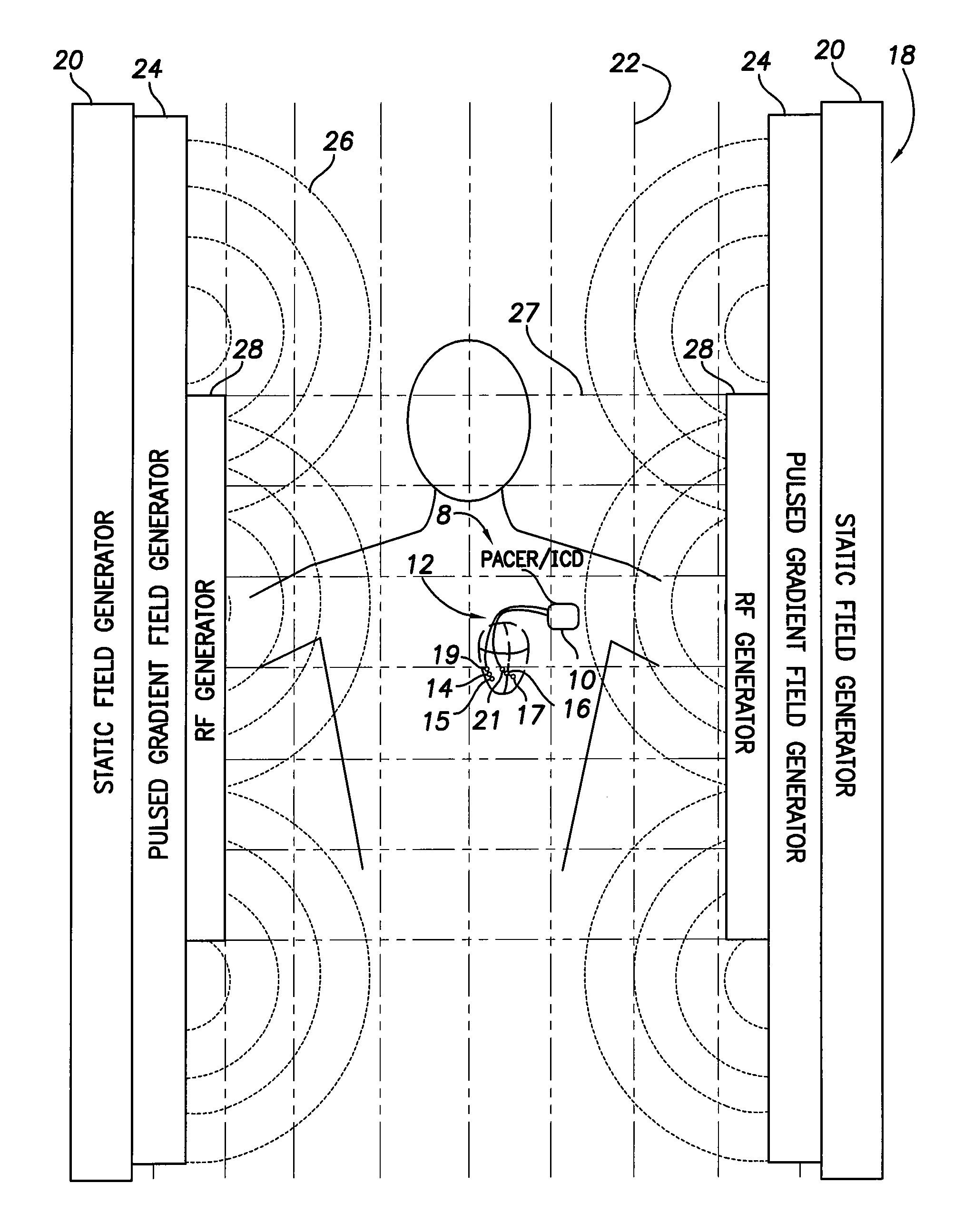 Systems and methods for exploiting the tip or ring conductor of an implantable medical device lead during an MRI to reduce lead heating and the risks of MRI-induced stimulation