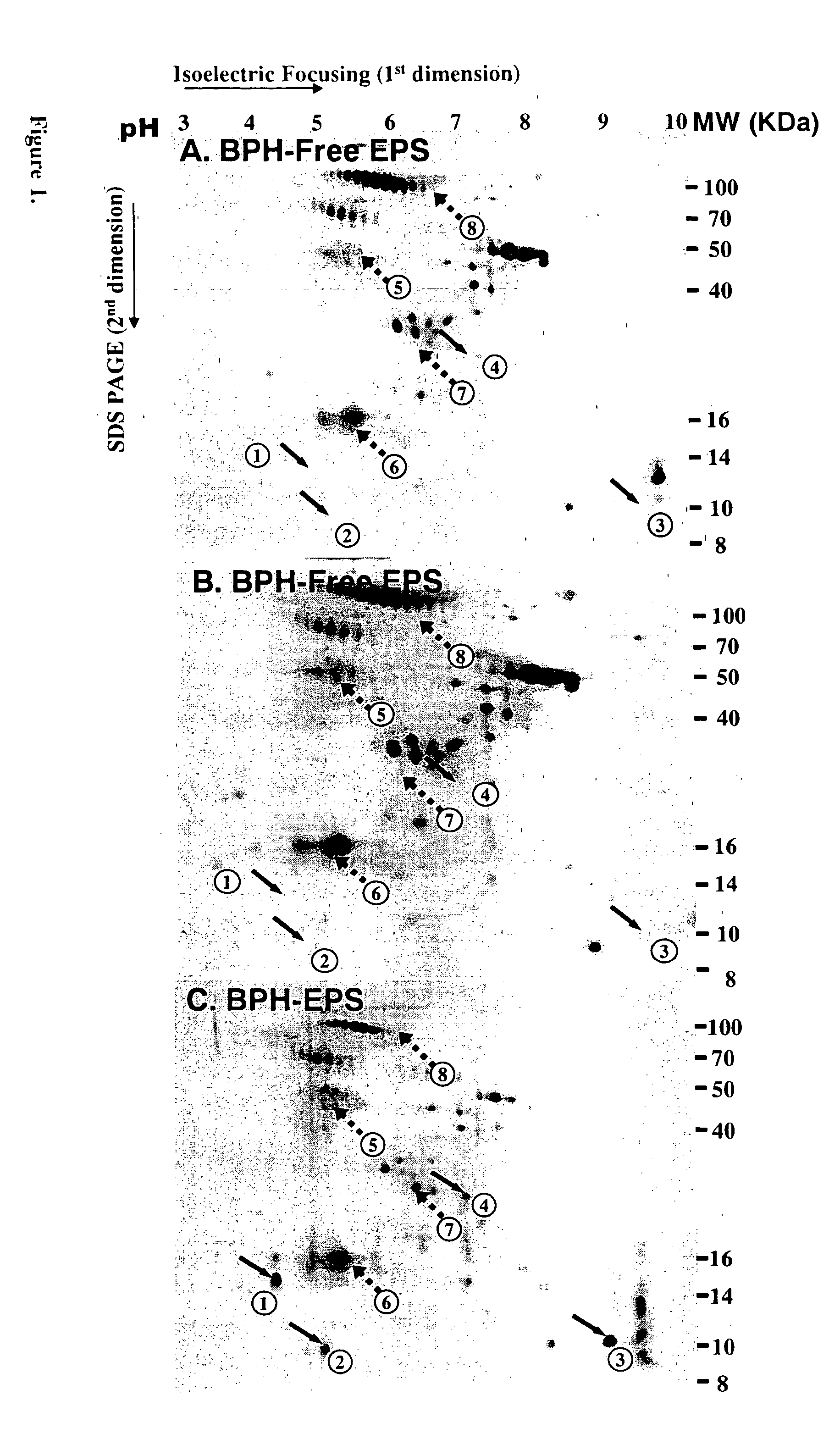 Protein markers for human benign prostatic hyperplasia (BPH)