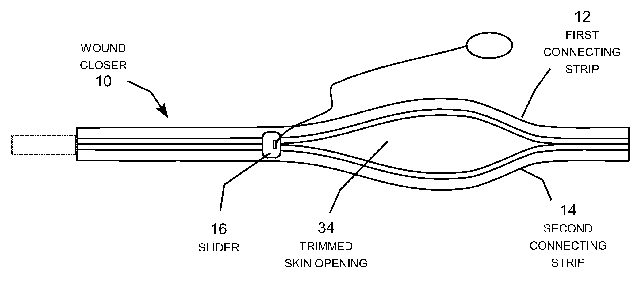 Method and device for mending skin openings