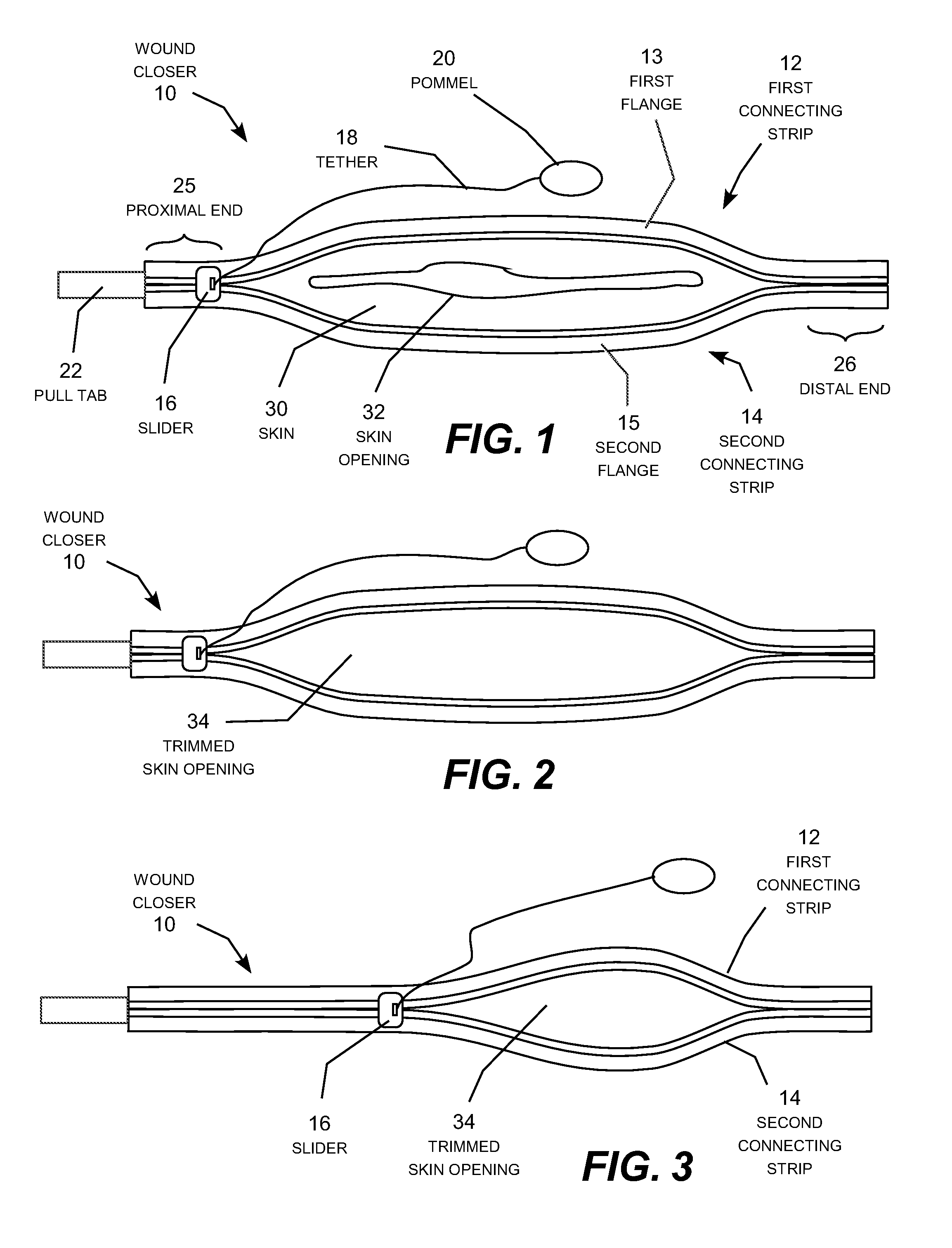 Method and device for mending skin openings