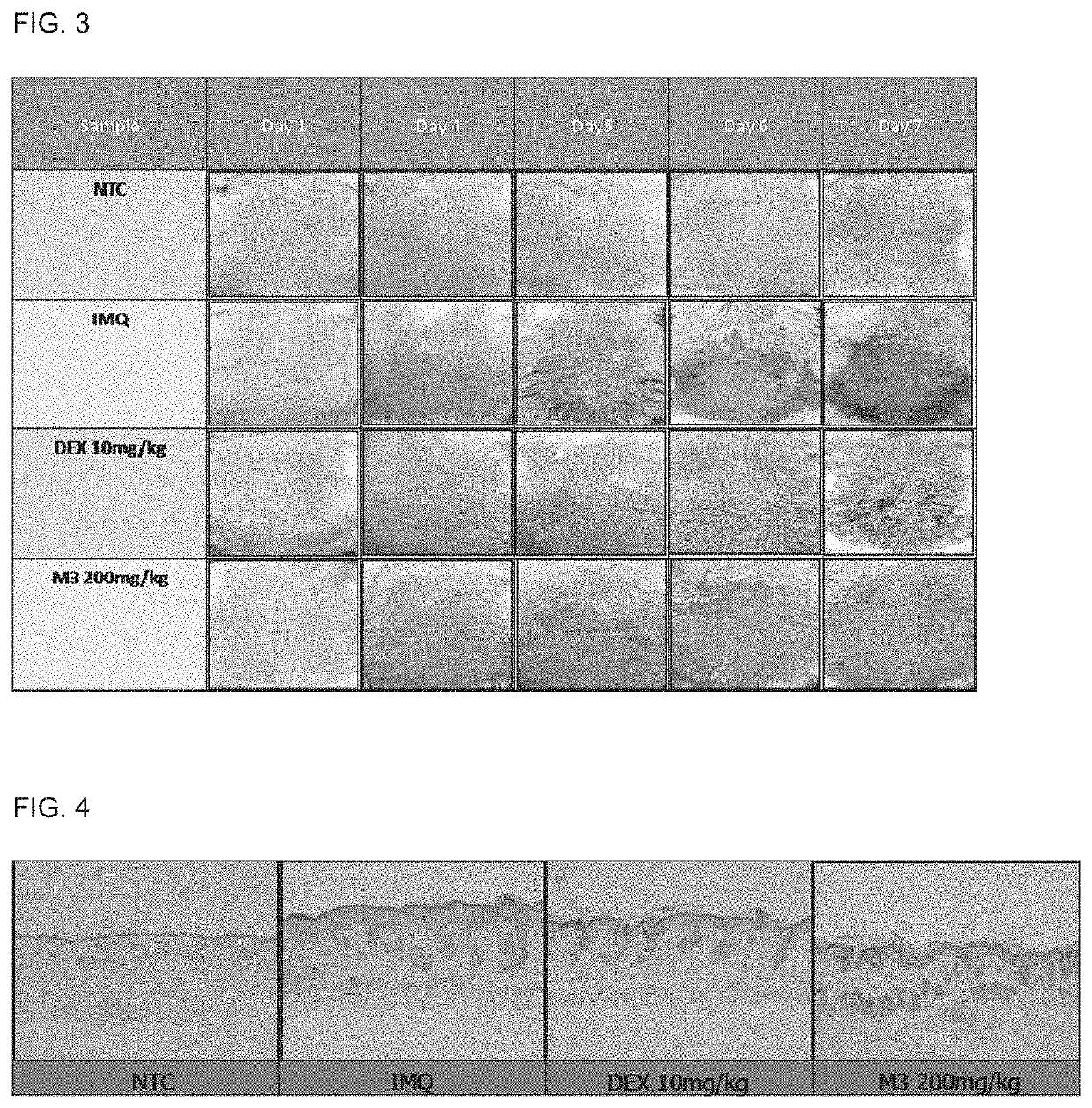 Composition for ameliorating psoriasis symptoms containing extract of thalictrum squarrosum steph