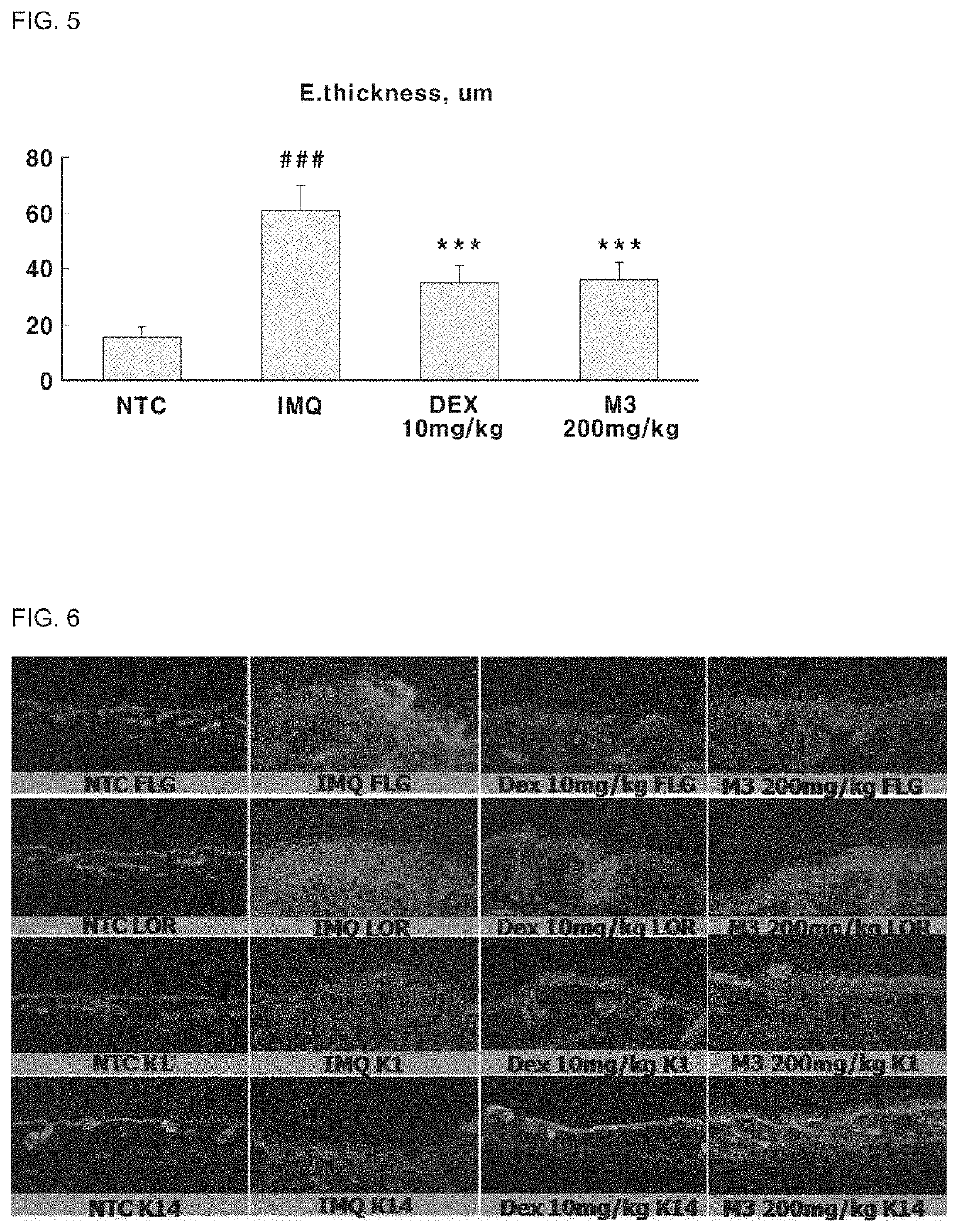 Composition for ameliorating psoriasis symptoms containing extract of thalictrum squarrosum steph