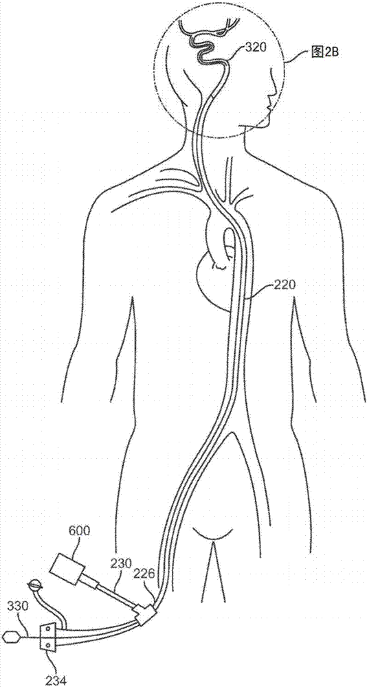 Rapid aspiration thrombectomy system and method