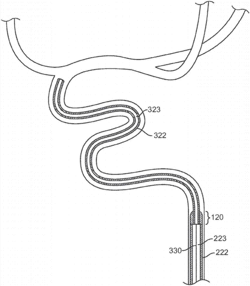Rapid aspiration thrombectomy system and method