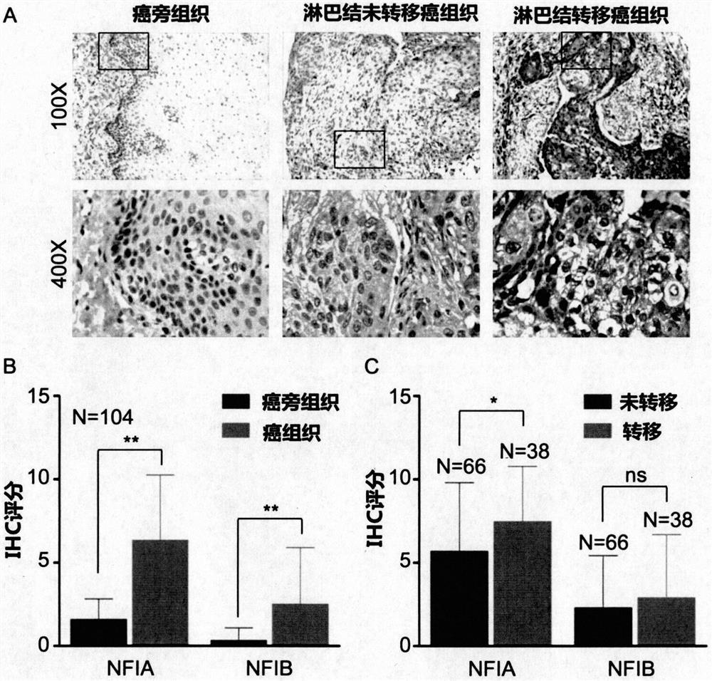 Application of nfi transcription factor in esophageal squamous cell carcinoma