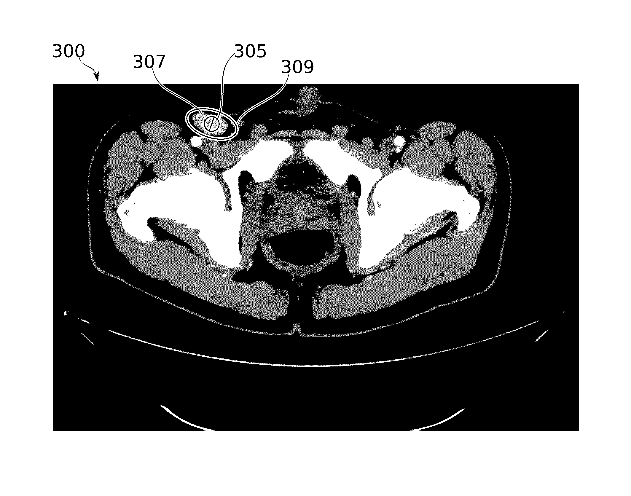 Method and system for spatial segmentation of anatomical structures