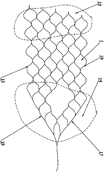 Intracranial vascular pincers type thrombus take-out device
