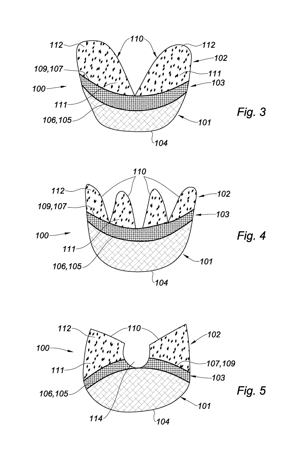 Prosthesis for supporting a breast structure