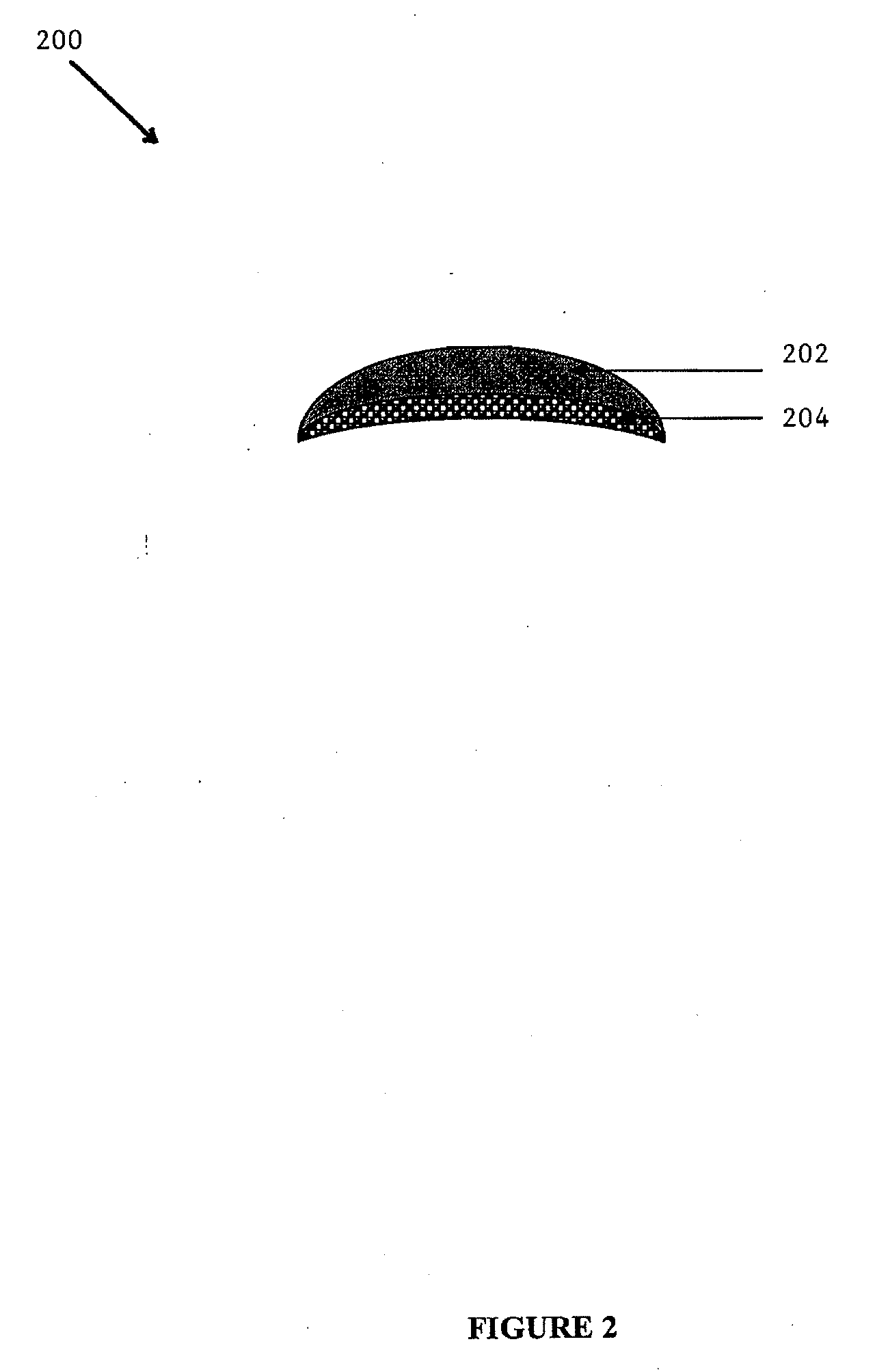 Composite Implants and Methods of Making and Using the Same