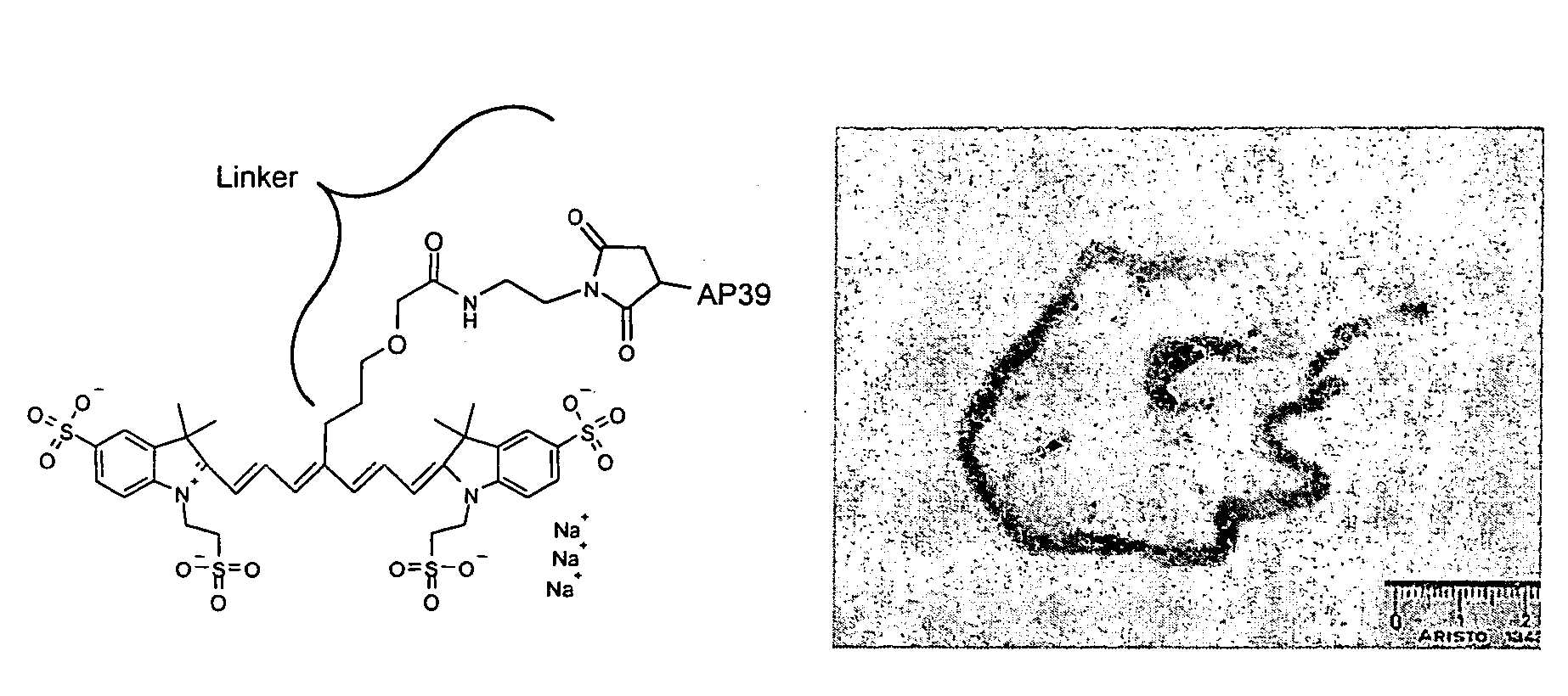 Use of cyanine dyes for the diagnosis of proliferative diseases