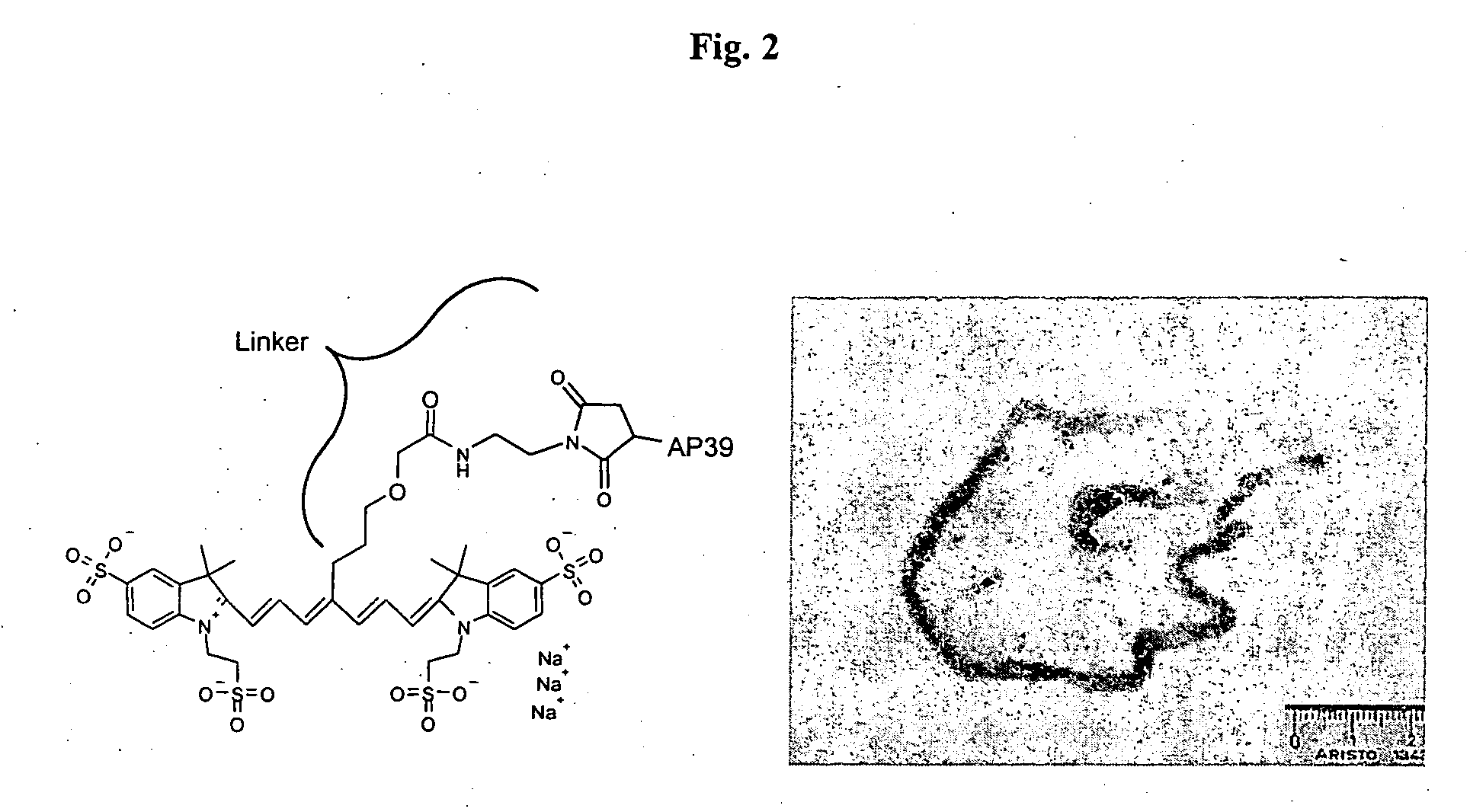 Use of cyanine dyes for the diagnosis of proliferative diseases