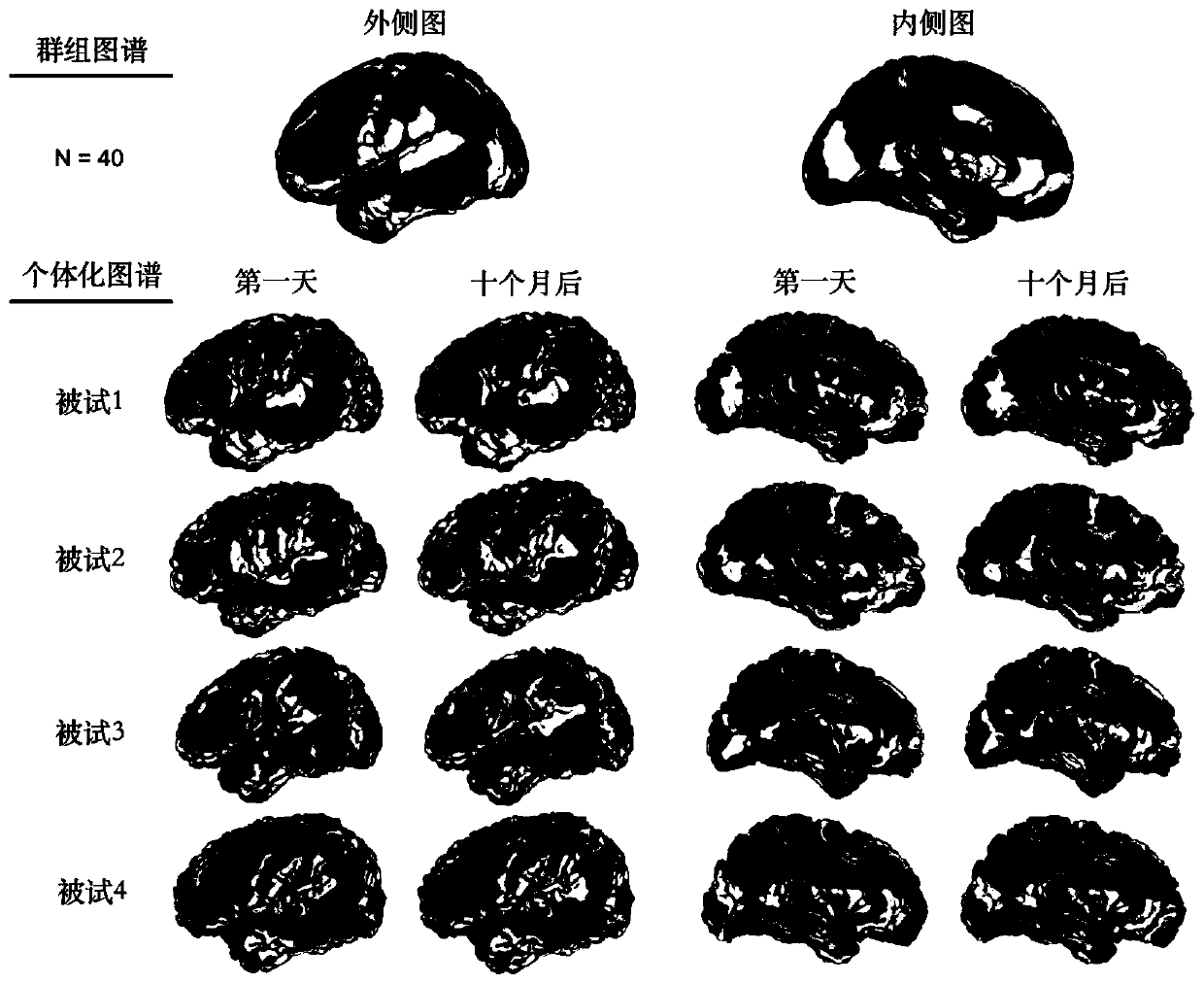 Individualized structure connection brain atlas drawing method based on diffusion magnetic resonance imaging fiber bundle tracking technology