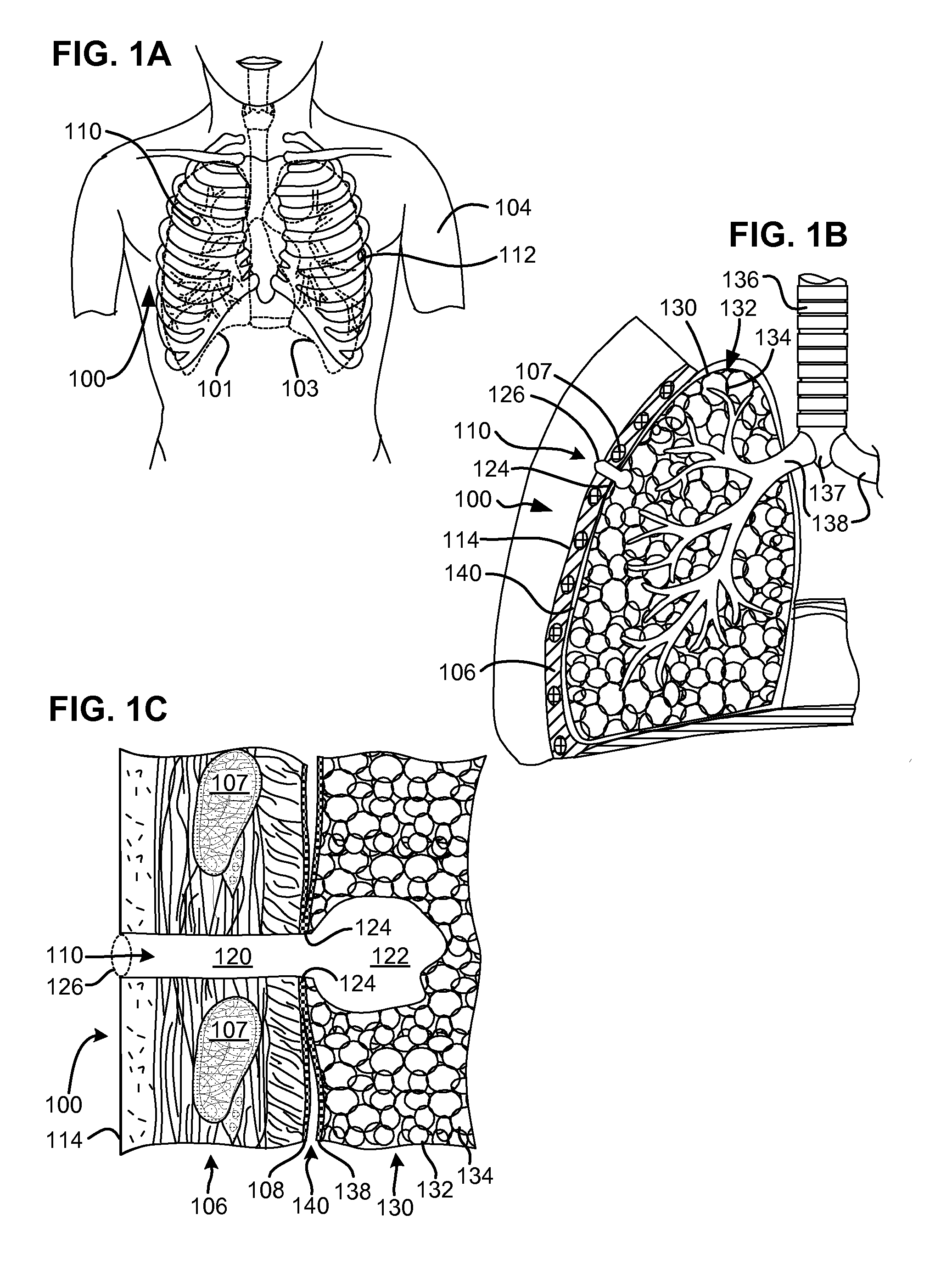 Methods and devices for follow-up care and treatment of a pneumstoma