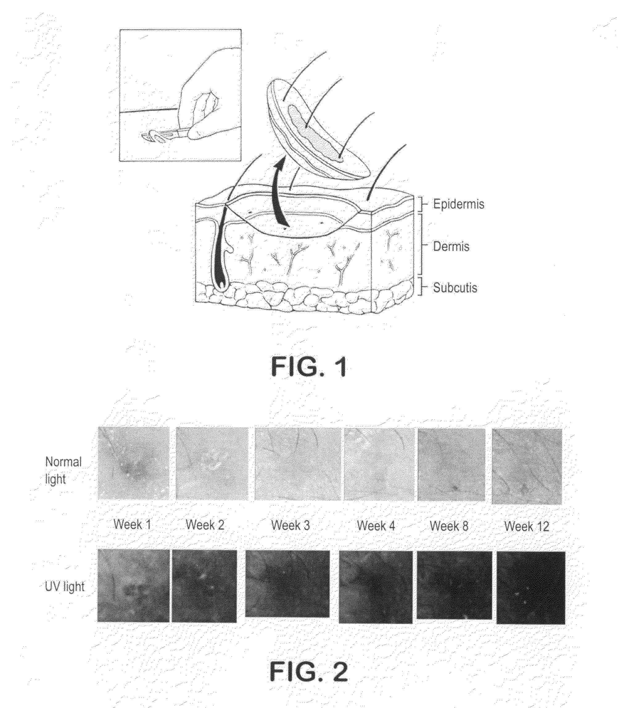Biopsy marker composition and method of use