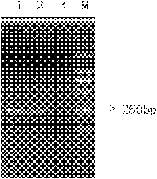 Method for detecting mycobacterium tuberculosis and special-purpose primers therefor