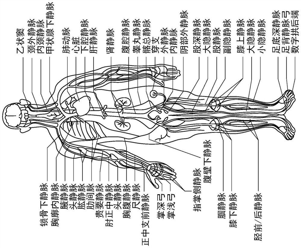 Intraluminal ultrasound imaging with automatic and assisted labels and bookmarks