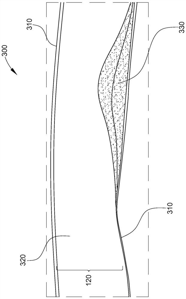 Intraluminal ultrasound imaging with automatic and assisted labels and bookmarks