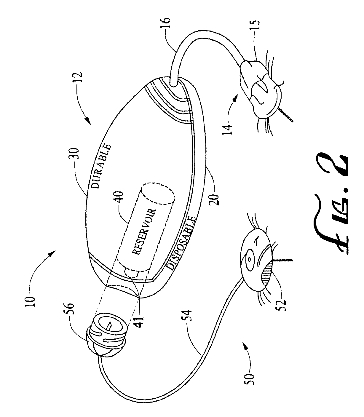Systems and methods allowing for reservoir filling and infusion medium delivery