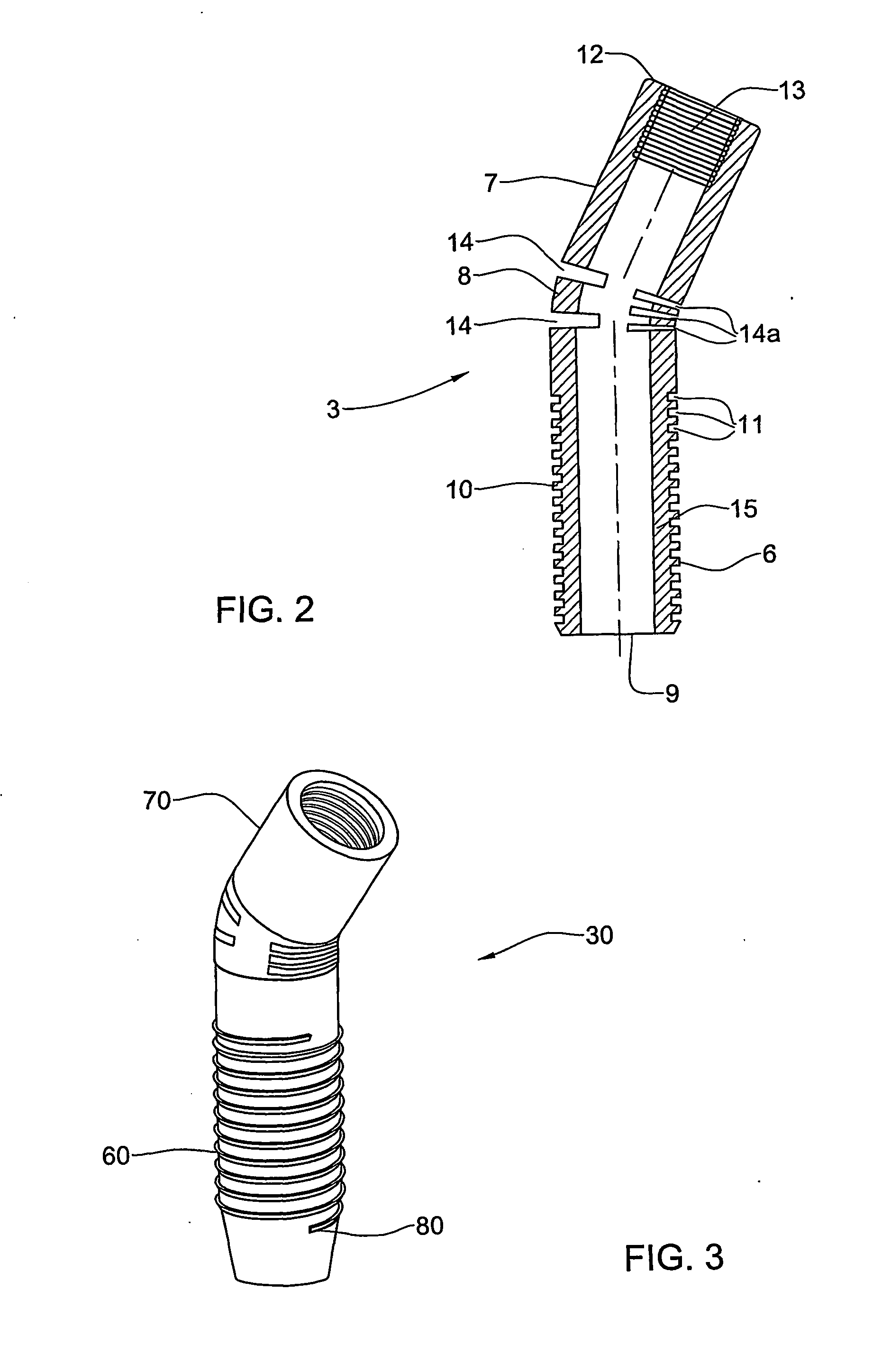 Implant having integral flexible abutment portion and method for use thereof