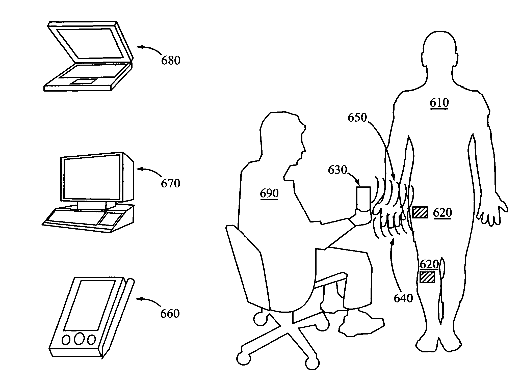 Method and apparatus for implant identification