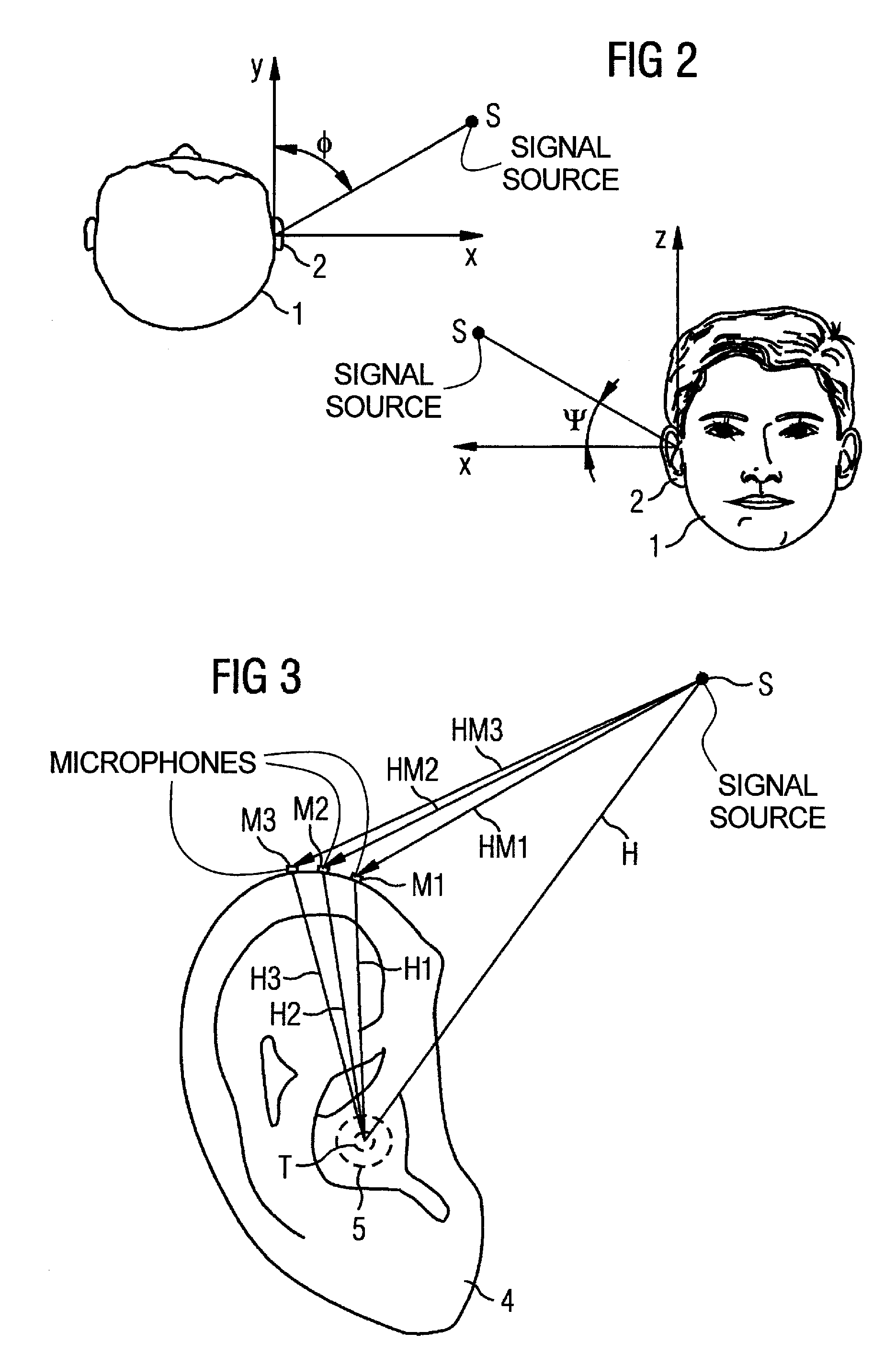 Hearing aid device, and operating and adjustment methods therefor, with microphone disposed outside of the auditory canal