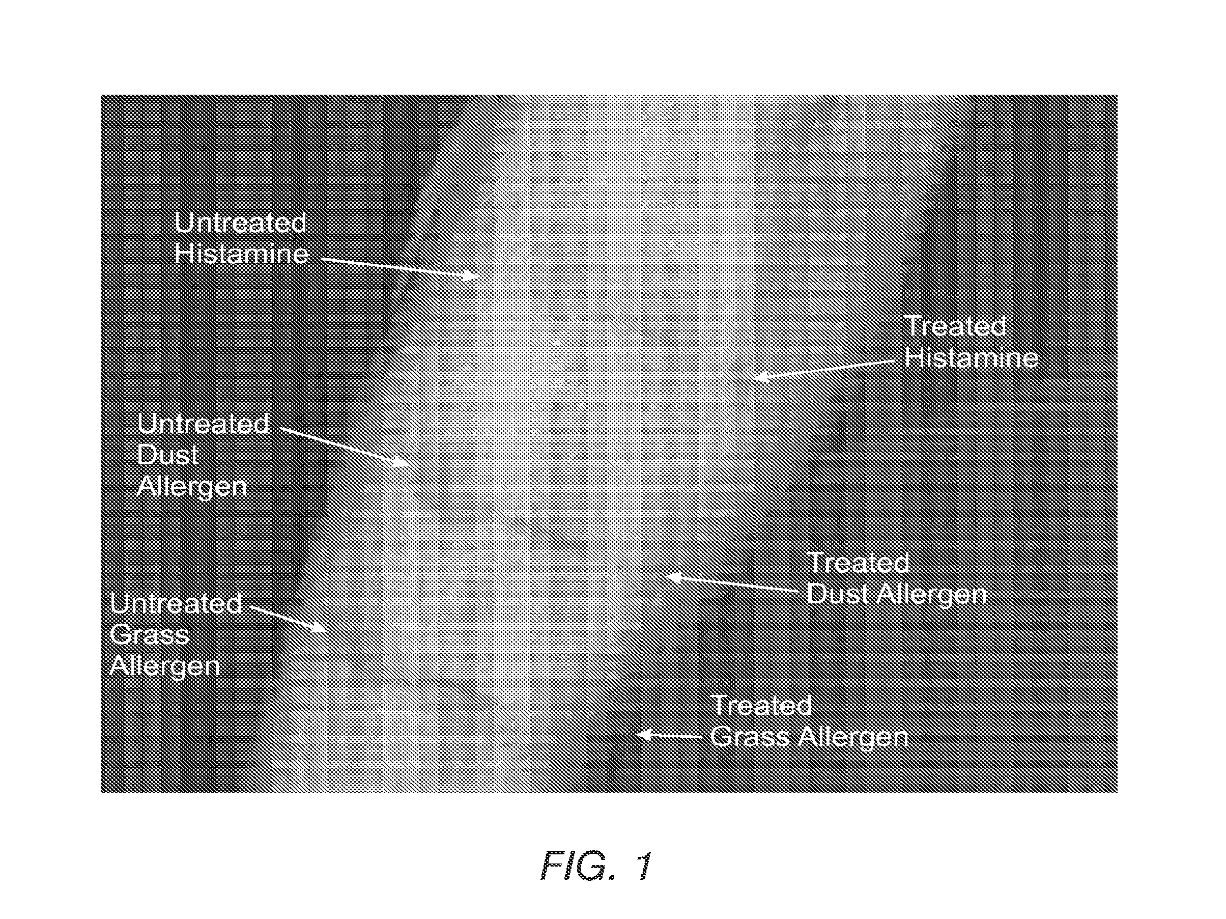 X-ray contrast media compositions and methods of using the same to treat, reduce or delay the onset of CNS inflammation and inflammation associated conditions