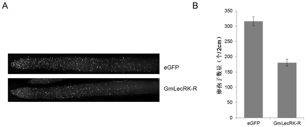 A gene gmlecrk-r for improving plant disease resistance and its application