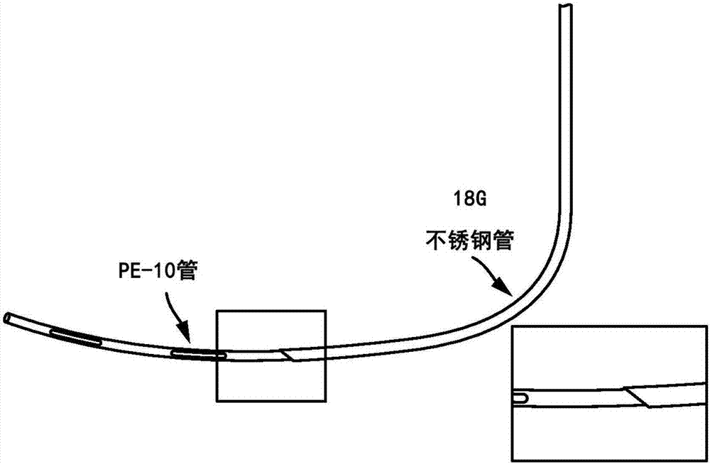 Spinal subpial gene delivery system