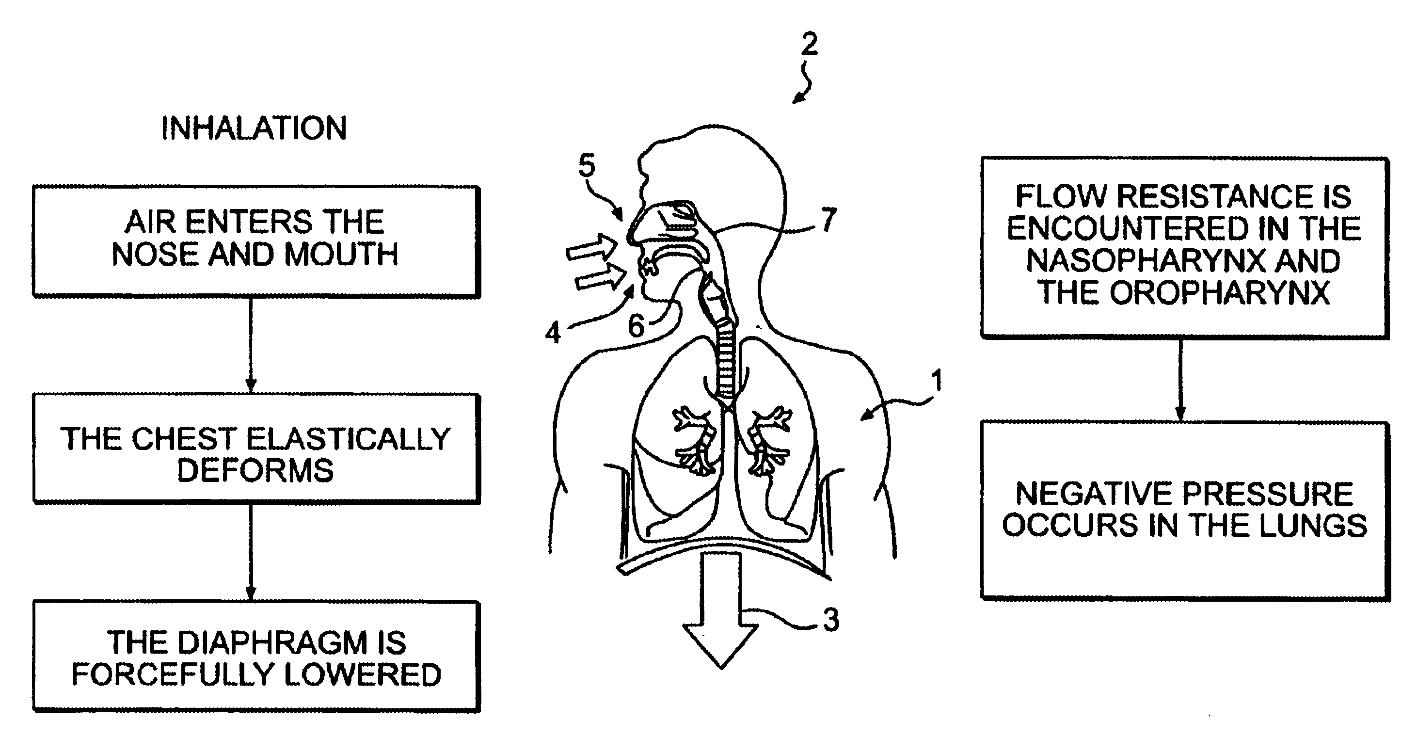 Mechanical lungs