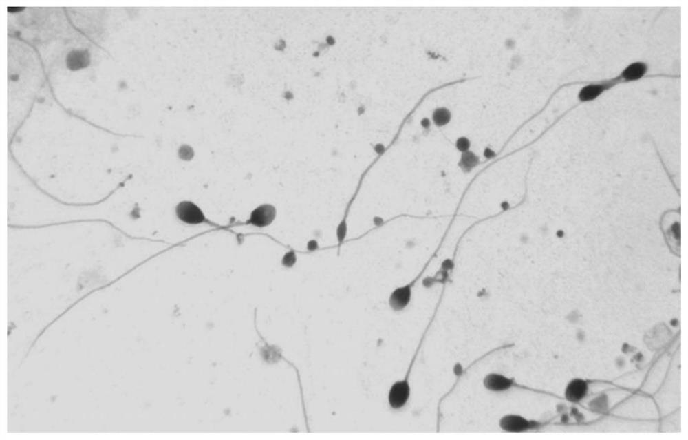 Automatic sperm morphology analysis method based on multi-scale feature fusion