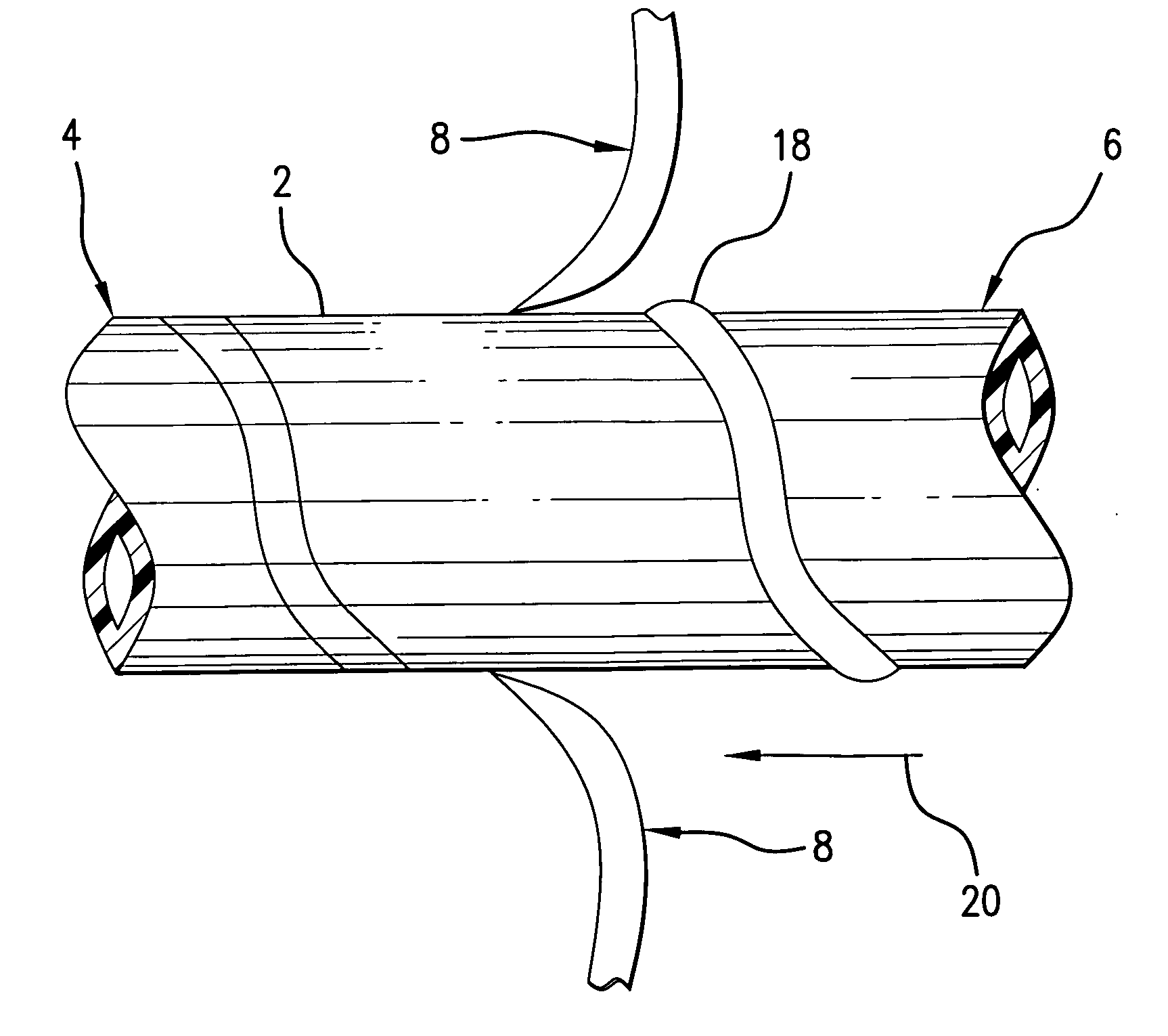 Polymer tube with embedded electrically conductive patterns and method for providing electrically conductive paths in polymer tubing