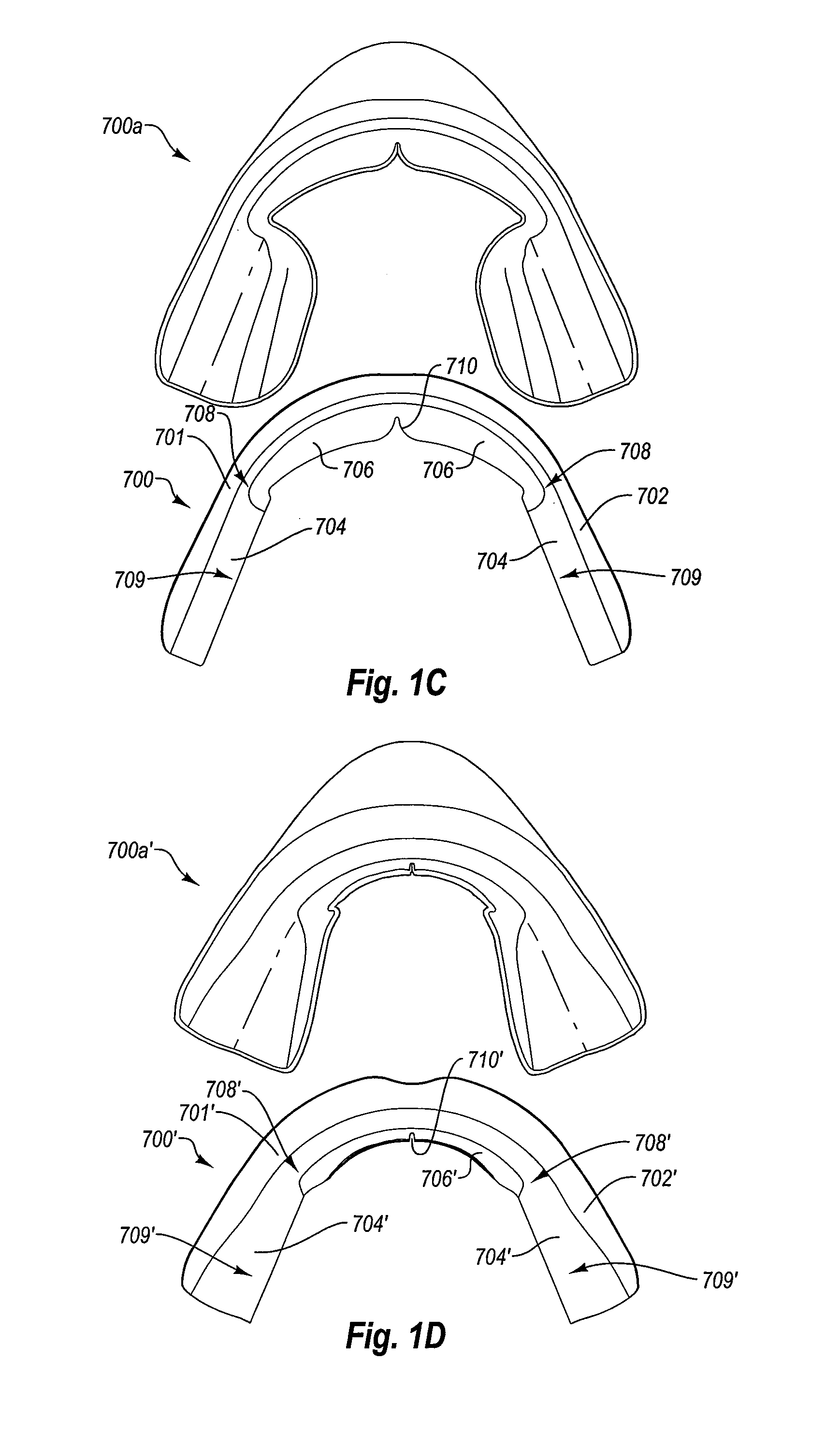 Non-custom dental treatment trays and mouth guards having improved anatomical features