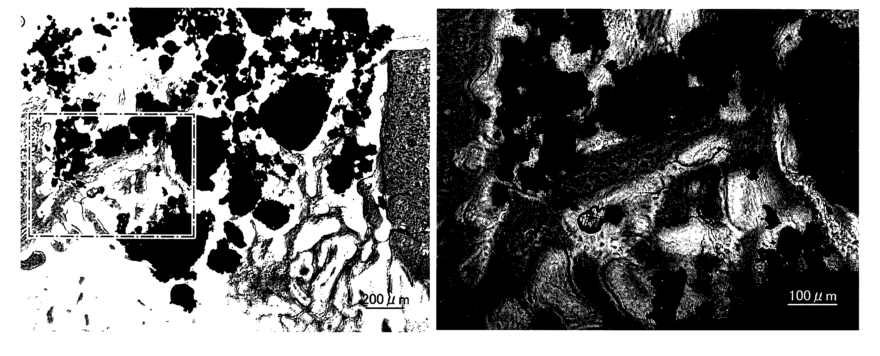 Bone filling material comprising sintered titanium dioxide and dextrin and method for reconstructing bone defects using the same