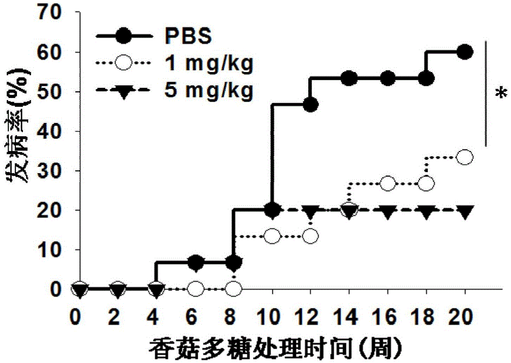 Use of lentinan in preparation of drug for preventing diabetes type 1